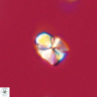 Sphenolithus sp 64957