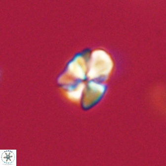 Sphenolithus sp 64958