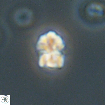 Sphenolithus sp 64963