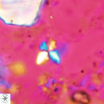 Sphenolithus spiniger 1974