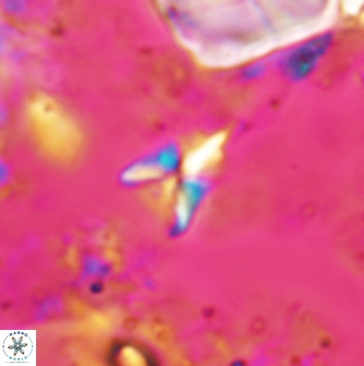 Sphenolithus spiniger 1975