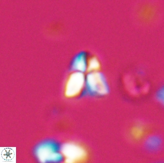 Sphenolithus spiniger 25822