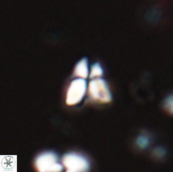 Sphenolithus spiniger 25823