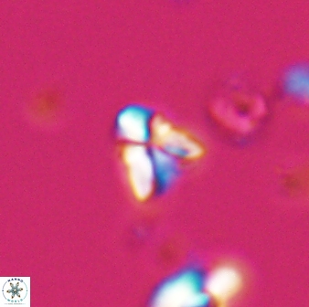 Sphenolithus spiniger 25824