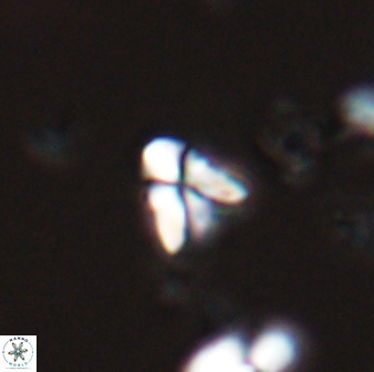 Sphenolithus spiniger 25825