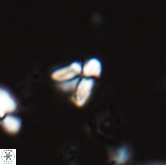 Sphenolithus spiniger 25827