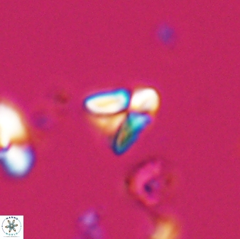 Sphenolithus spiniger 25828