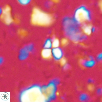 Sphenolithus spiniger VR 025803