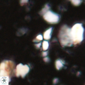 Sphenolithus spiniger VR 025814