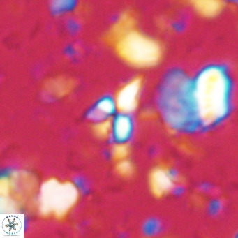 Sphenolithus spiniger VR 025815
