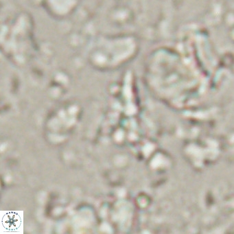Sphenolithus spiniger VR 025816