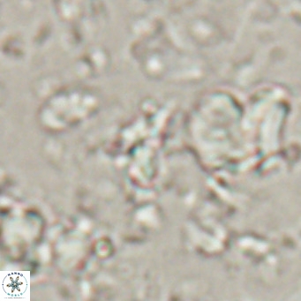 Sphenolithus spiniger VR 025817