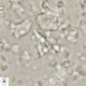 Sphenolithus spiniger VR 025818