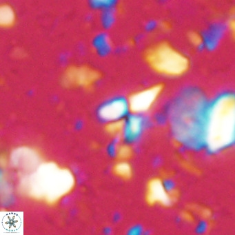Sphenolithus spiniger VR 025810