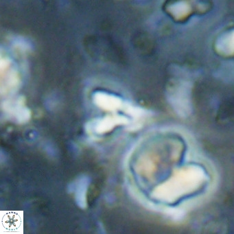 Sphenolithus spiniger VR 025820