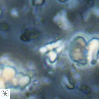 Sphenolithus spiniger VR 025821