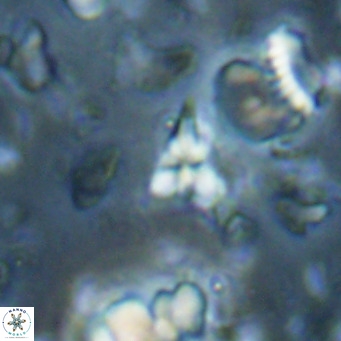 Sphenolithus spiniger VR 025822