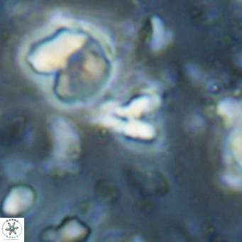 Sphenolithus spiniger VR 025823