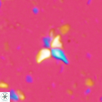 Sphenolithus spinula 1935