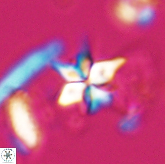 Sphenolithus stellatus 26065