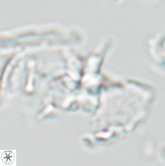 Sphenolithus stellatus 26071