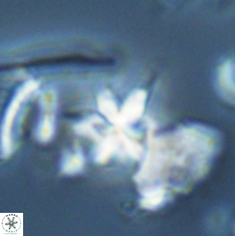 Sphenolithus stellatus 26072
