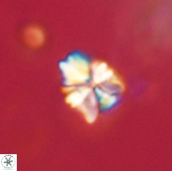 Sphenolithus paleodissimilis 63249