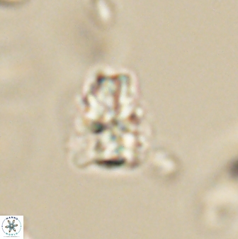 Sphenolithus paleodissimilis 63255
