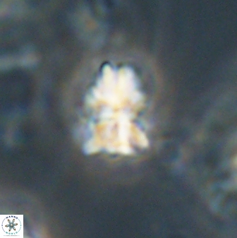 Sphenolithus paleodissimilis 63256