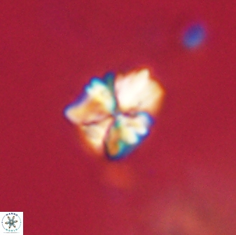 Sphenolithus paleodissimilis 63258