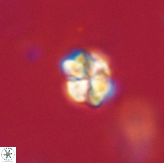 Sphenolithus paleodissimilis 63259