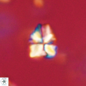 Sphenolithus paleodissimilis 63253