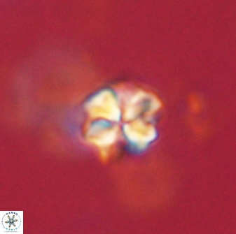 Sphenolithus paleodissimilis 63265