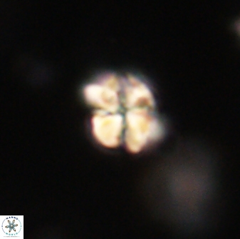 Sphenolithus paleodissimilis 63260