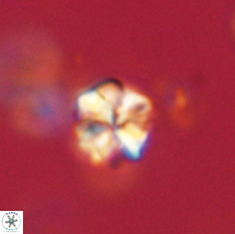 Sphenolithus paleodissimilis 63262