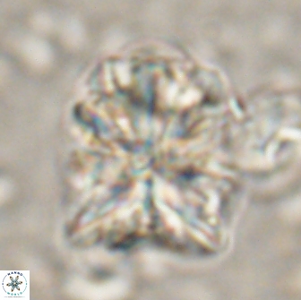 Sphenolithus paleograndis 14647