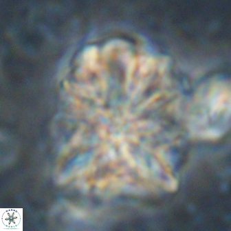 Sphenolithus paleograndis 14648