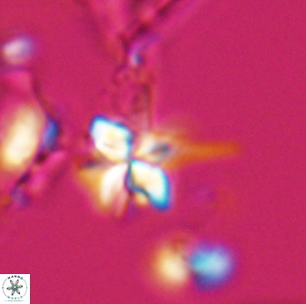 Sphenolithus perpendicularis 26057