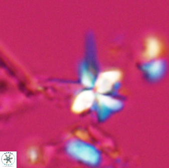 Sphenolithus perpendicularis 26059