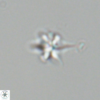 Sphenolithus perpendicularis 26051
