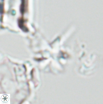 Sphenolithus perpendicularis 26061