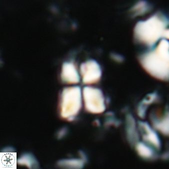 Sphenolithus philippinensis 190