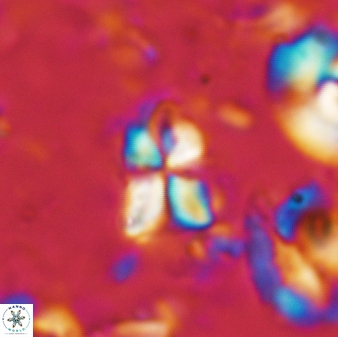 Sphenolithus philippinensis 191