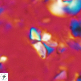 Sphenolithus philippinensis 192