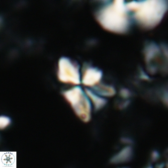 Sphenolithus philippinensis 193