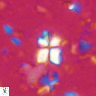 Sphenolithus philippinensis 27832