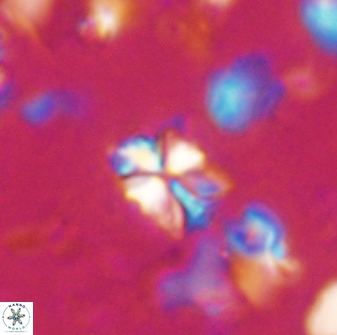 Sphenolithus philippinensis 27833