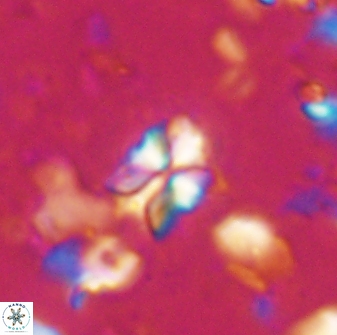 Sphenolithus philippinensis 27835