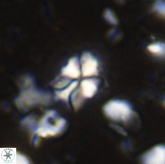 Sphenolithus philippinensis 27836