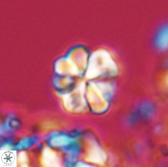 Sphenolithus primus 28704